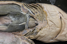repository_1193-Thumbnail Image.jpg